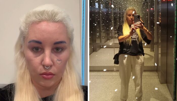 Amanda Bynes Opens Up About Weight Gain Amid Depression Struggle: “[I] gained over 20 lbs”