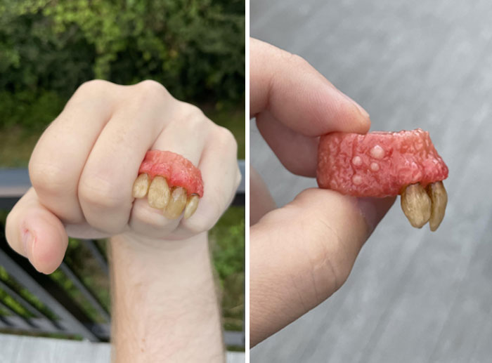Tooth And Gum Ring
