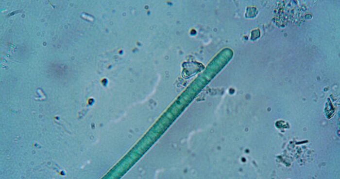 Worms Living In Chernobyl Exclusion Zone Have Super Ability That Humans Don’t Have