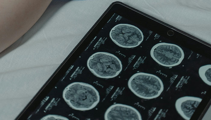 Man’s Habit Of Eating “Lightly Cooked” Bacon Likely Led To Tapeworm Infection, Doctors Say Man’s Habit Of Eating “Lightly Cooked” Bacon Likely Led To Tapeworm Infection, Doctors Say