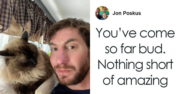 Before And After Of Man Who Received “Amazing” Nasal Reconstruction After Getting Mauled By Dog