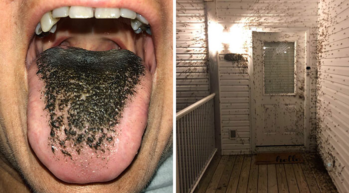 55 Of The Most ‘Mildly Disgusting’ Thing Seen Out In The Wild