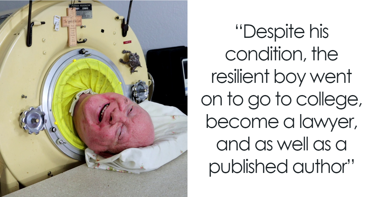 Paul Alexander, Man Who Lived Inside Iron Lung For 70 Years, Passes Away At 78 - Vimarsana News