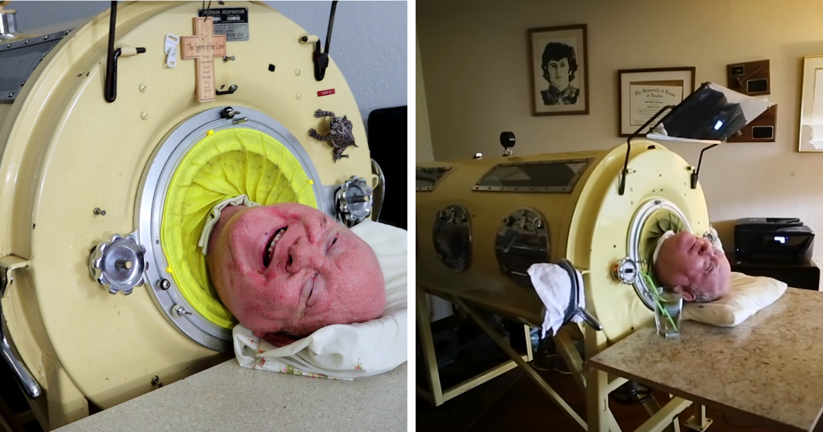 Experiencing Appendicitis Symptoms Unexpected Advice From A Nurse