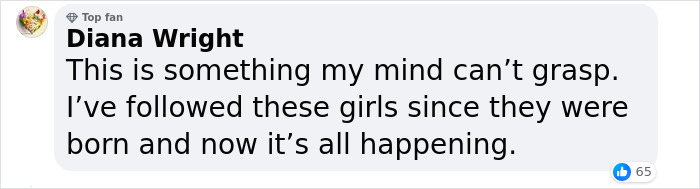 Dicephalus-Conjoined Twin Abby Hensel Of “Abby & Brittany” Is Married Dicephalus-Conjoined Twin Abby Hensel Of “Abby & Brittany” Is Married