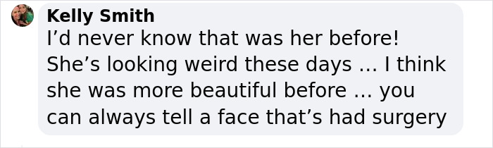 “Shouldn’t Have Done Anything”: People React To Megan Fox’s Long List Of Plastic Surgeries “Shouldn’t Have Done Anything”: People React To Megan Fox’s Long List Of Plastic Surgeries