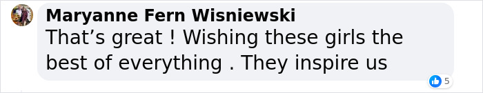 Dicephalus-Conjoined Twin Abby Hensel Of “Abby & Brittany” Is Married Dicephalus-Conjoined Twin Abby Hensel Of “Abby & Brittany” Is Married