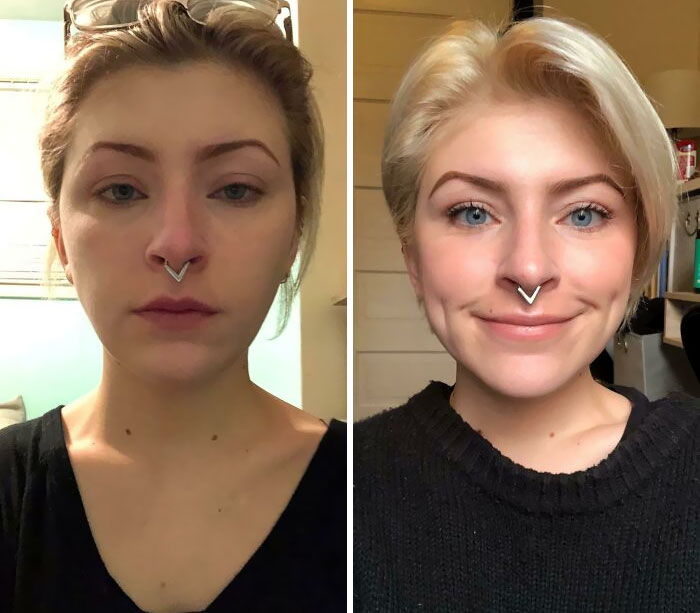 2 Years Sober Of Drugs And 2 Months Sober Of Alcohol. Left Is At My Lowest After A Bender And Right Is Me Today Sober. Thank You For All The Advice And Confidence