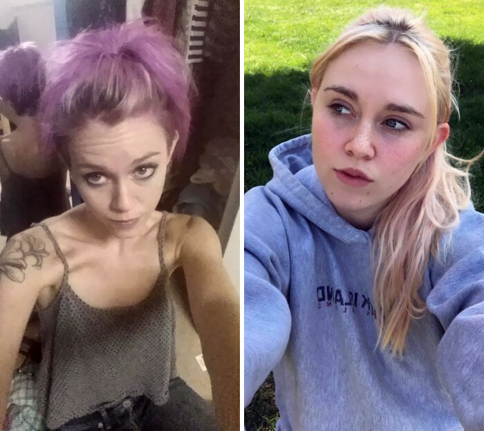 2 Years Sober And Recovering From Anorexia. 4 Years Between Pics - It’s Been A Long Journey. When I See Old Pictures I Hardly Recognize That Crazy Sad Girl, But I Feel For Her