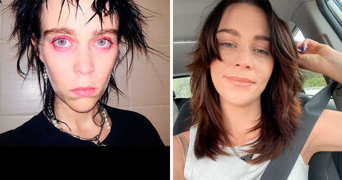 50 Before And After Pictures That Show The Effects Of Going Sober (New Pics)