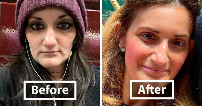 50 Powerful Before And After Transformations Of People Who Beat Their Addiction (New Pics)