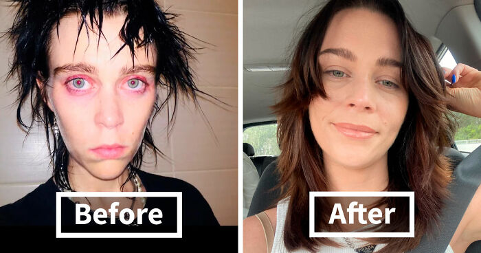 50 People Who Beat Their Addiction Share Before And After Pics (New Pics)