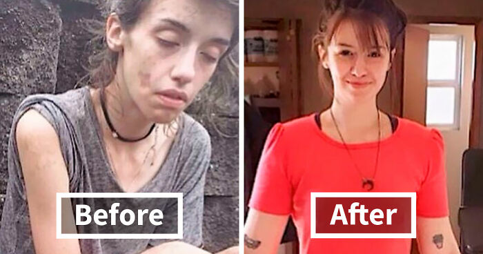 50 People Who Beat Their Addiction Share Before And After Pics (New Pics)