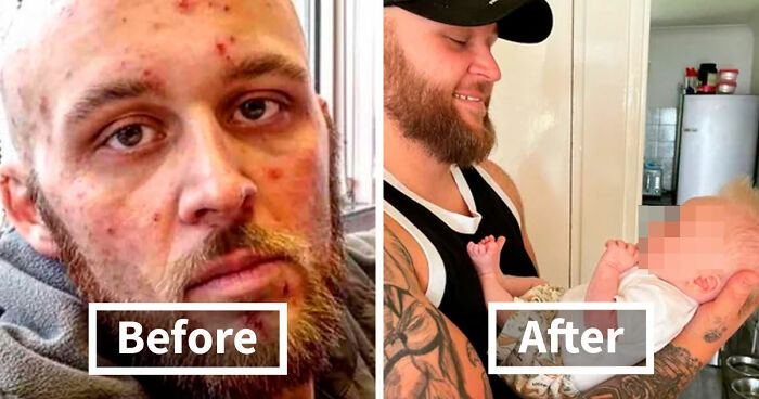 50 Powerful Before And After Transformations Of People Who Beat Their Addiction (New Pics)