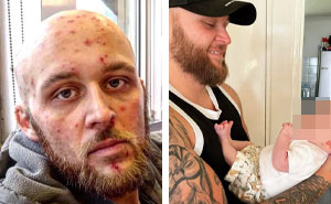 50 Before And After Pictures That Show What Happens When People Overcome Addiction (New Pics)