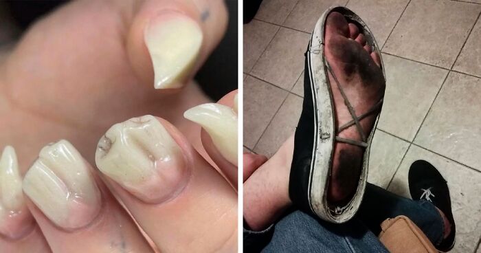 35 Unsettling Pics That Might Immediately Get A “Thanks, I Hate It” Response From You