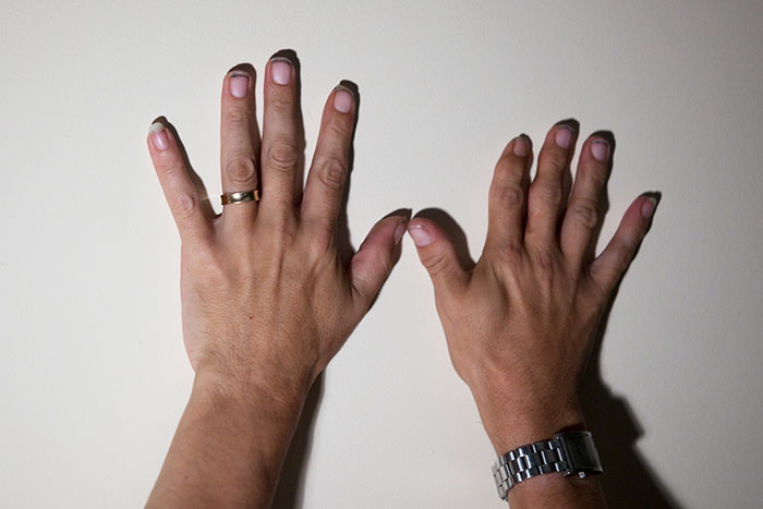 40 People Share The Weirdest Things About Their Bodies