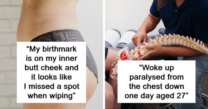 66 Times Something Extra Abnormal Happened With People’s Bodies, As Shared In This Online Thread