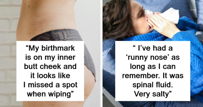 40 People Share The Weirdest Things About Their Bodies | Bored Panda