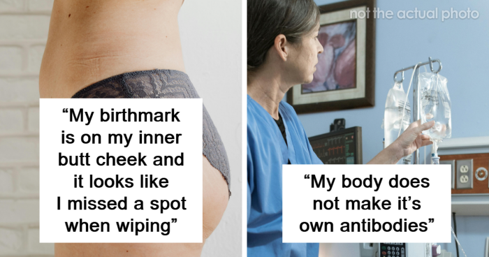 66 Times Something Extra Abnormal Happened With People’s Bodies, As Shared In This Online Thread