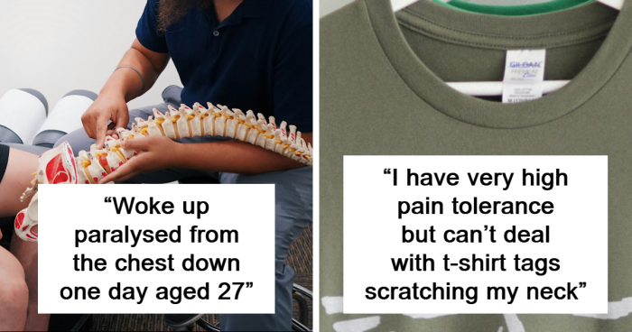 66 People Share The Weirdest Things About Their Bodies