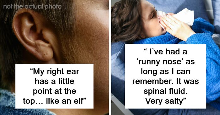 66 People Share Cool Or Pretty Disturbing Things About Their Bodies