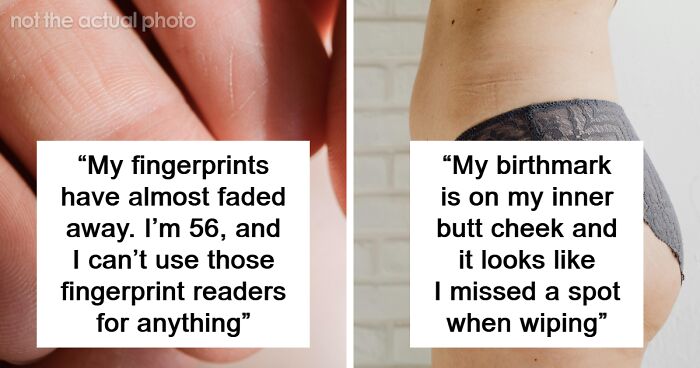 66 People Share The Weirdest Things About Their Bodies