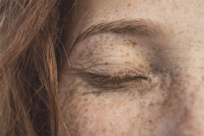 Woman Misses Her Freckles So She Paints Them On, Gets Called Out For 'Cultural Appropriation'