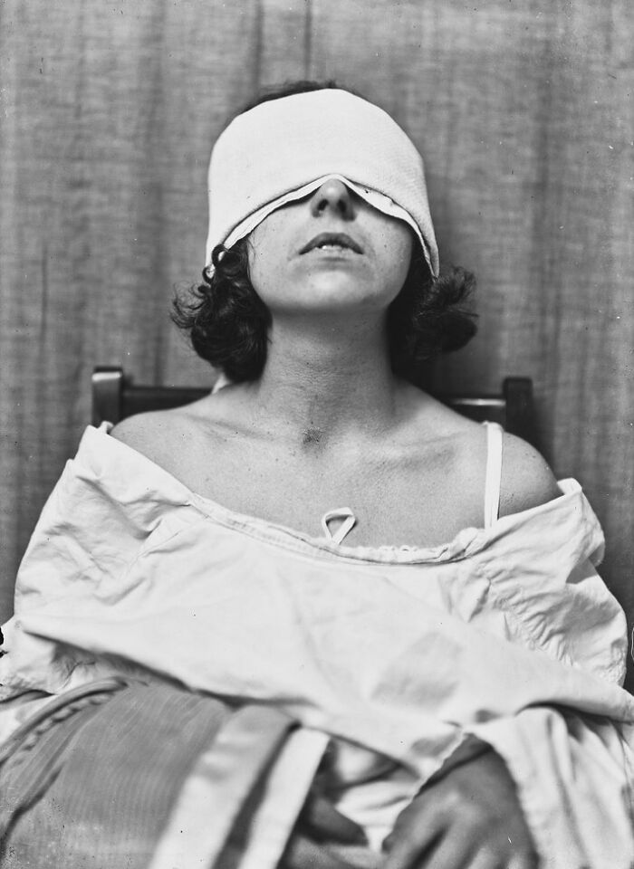 Surgery Patients Of Dr. Harvey Cushing