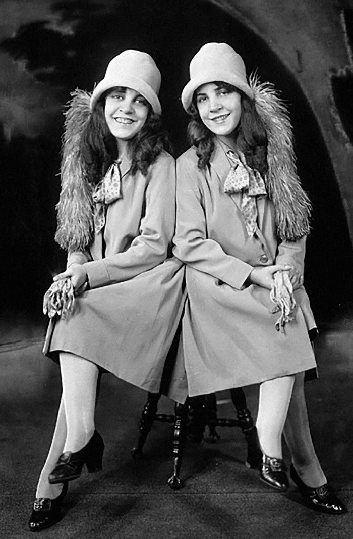 People Learn Harrowing Story Of Conjoined Twins, Which Ended With One Alive And The Other Not People Learn Harrowing Story Of Conjoined Twins, Which Ended With One Alive And The Other Not