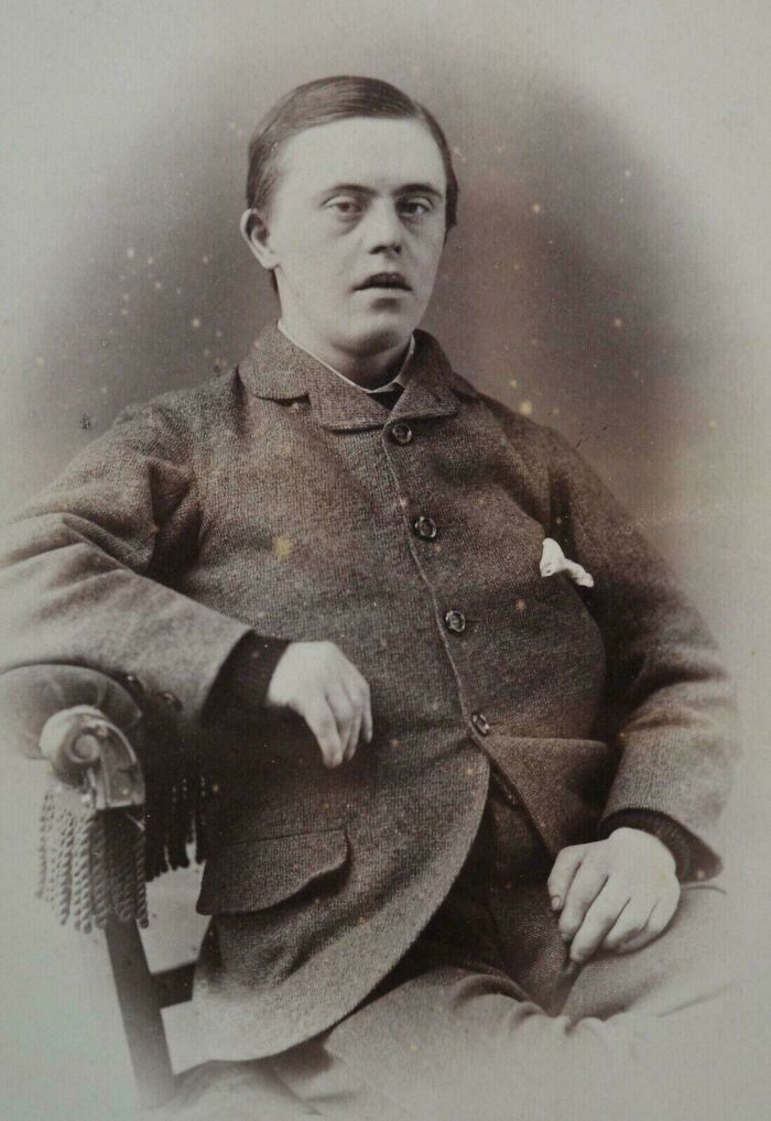 Hombre con síndrome de Down en 1890