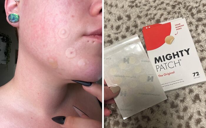 Banish Blemishes Overnight: Mighty Patch™ For Pimple-Free Skin!