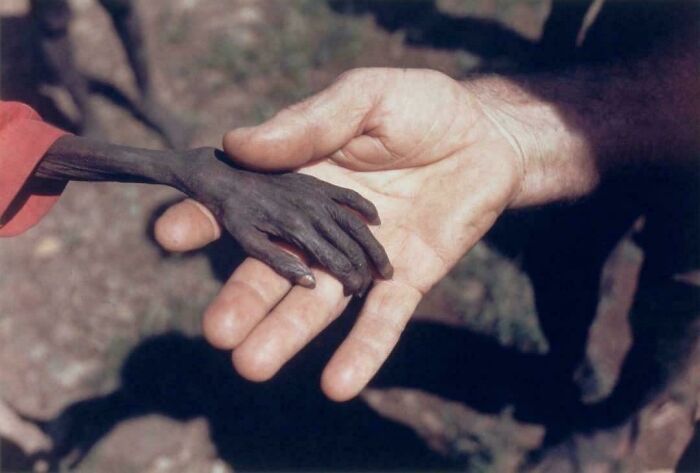 Misionero católico sosteniendo la mano de un niño desnutrido en Uganda, 1980