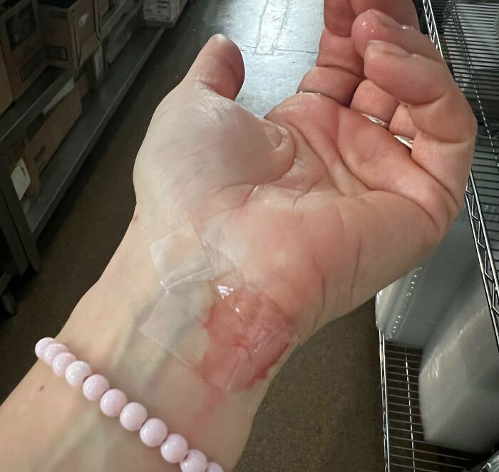 No Bandages. Tape It Up, Finish The Shift, And Don't Show Customers. It Wasn't Serious And Stopped Pretty Quick, But How Does A Restaurant Not Have Bandages?