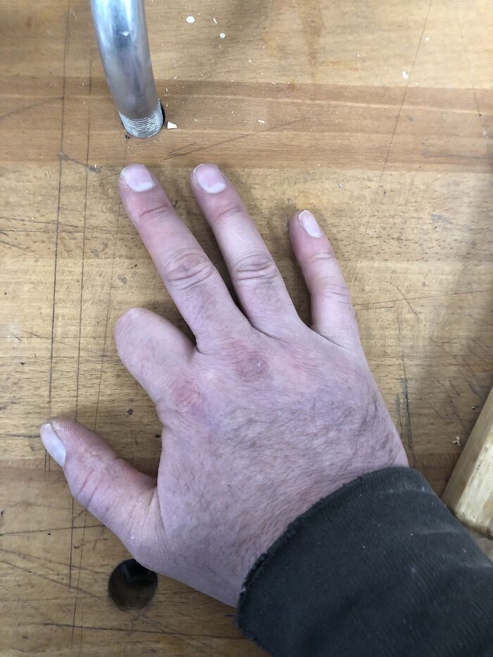 As A Woodworker I Can’t Stress Enough To Pay Attention. This Is What My Hand Would Look Like If I Cut Off A Finger. It’s Just In A Hole Right Now
