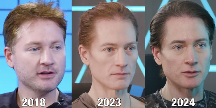 Biohacker, 46, Who Wants To Stop His Body’s Aging Process, Trolled Online After Sharing Update
