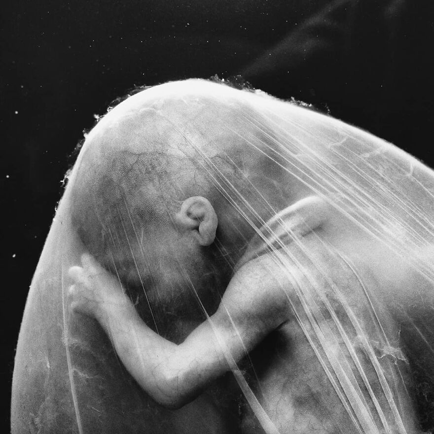 Meet Lennart Nilsson, The Photographer Who Spent 12 Years Photographing The Development Of Fetuses