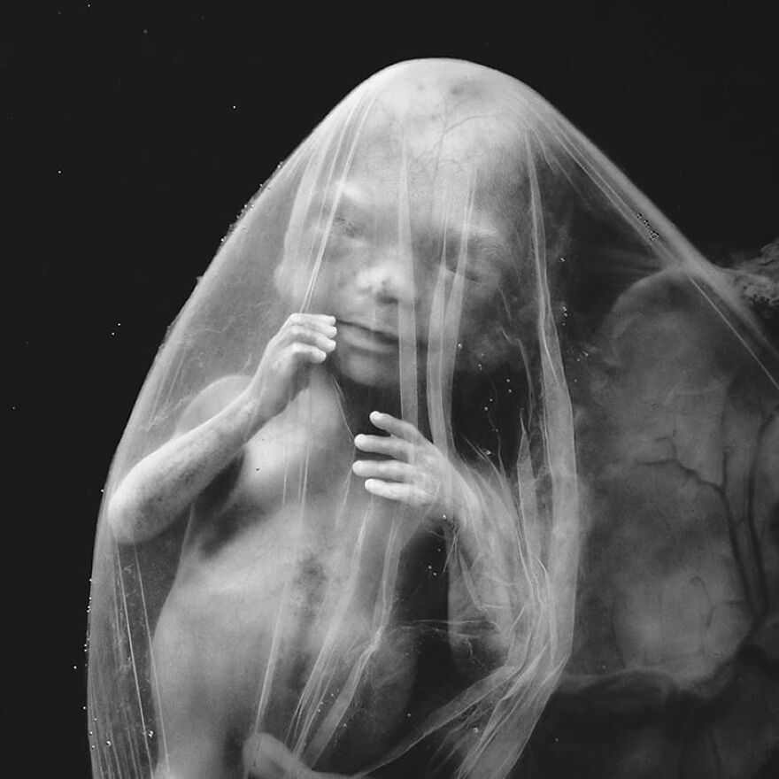Meet Lennart Nilsson, The Photographer Who Spent 12 Years Photographing The Development Of Fetuses