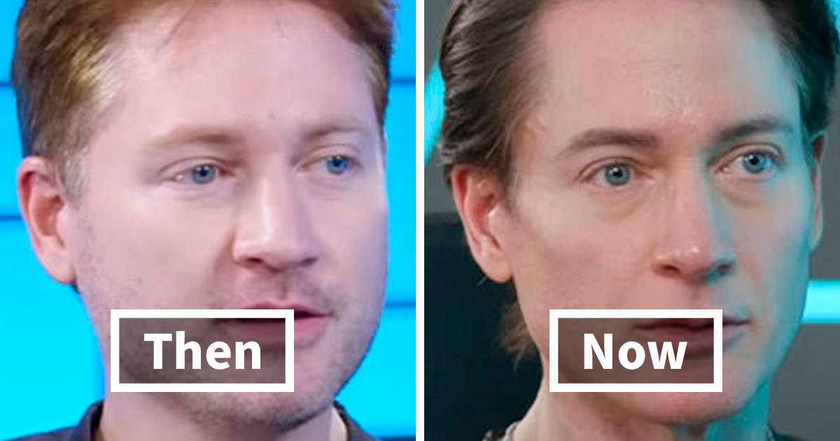 Biotech CEO Who Used Son's Blood To "Reverse Aging" Says He's "Transitioning" - Vimarsana News