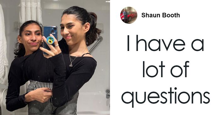 Conjoined Twins Speak Out After Viral Photos Leave People With A Mountain Of Questions