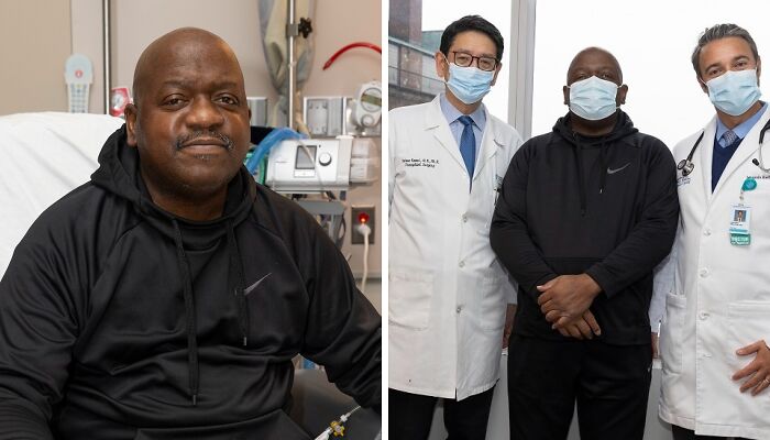 “One Of The Happiest Moments”: Man Who Receives First Pig Kidney Transplant Shares Moving Message