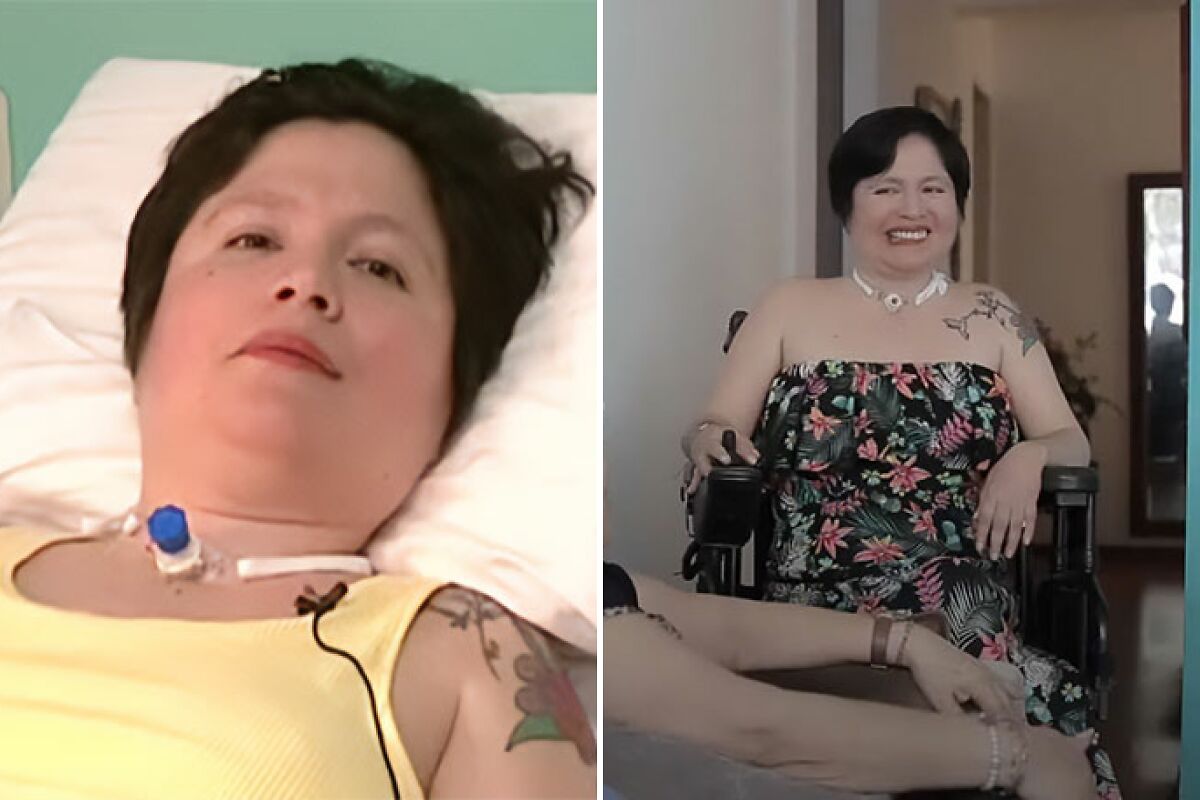 Woman Finally Euthanized In Peru Amid Legal Battle, Lived With Incurable Disease For 30 Years
