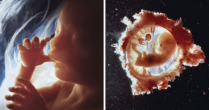 19 Groundbreaking Images By This Photographer Offering A Glimpse Into The Miracle Of Birth