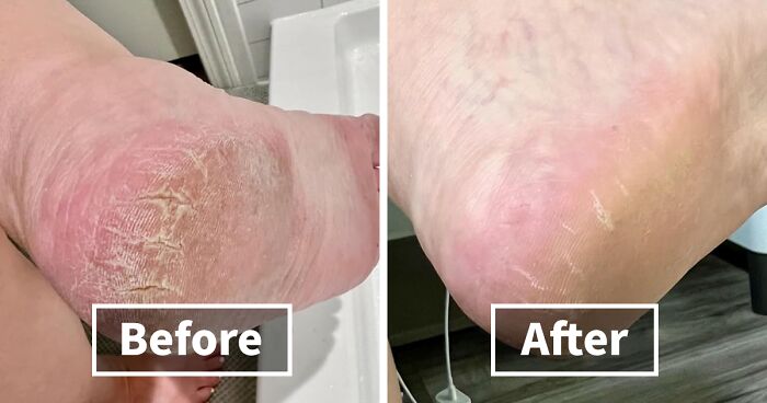 31 Hacks That Make Every Day Feel Like A Walk In The Park