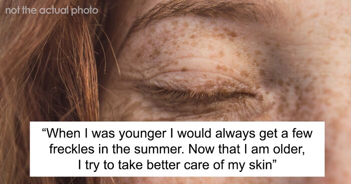 Woman Misses Her Freckles So She Paints Them On, Gets Called Out For ‘Cultural Appropriation’