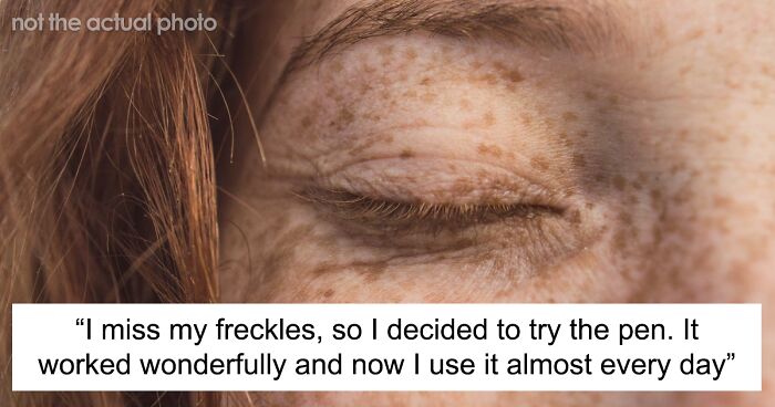 “Have You Always Had Freckles?”: Woman Freaks Over Fake Freckles