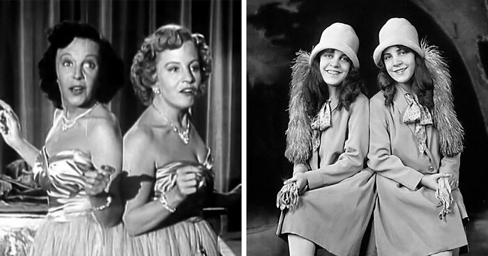 People Learn Harrowing Story Of Conjoined Twins, Which Ended With One Alive And The Other Not