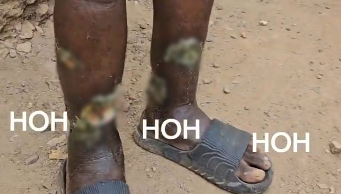 “Zombie Psychoactive” Users Begin Digging Up Graves For Ingredients, Prompting National Emergency “Zombie Psychoactive” Users Begin Digging Up Graves For Ingredients, Prompting National Emergency