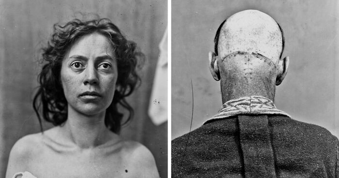 20 Haunting Medical Portraits Of Harvey Cushing’s Patients In The Early 20th Century