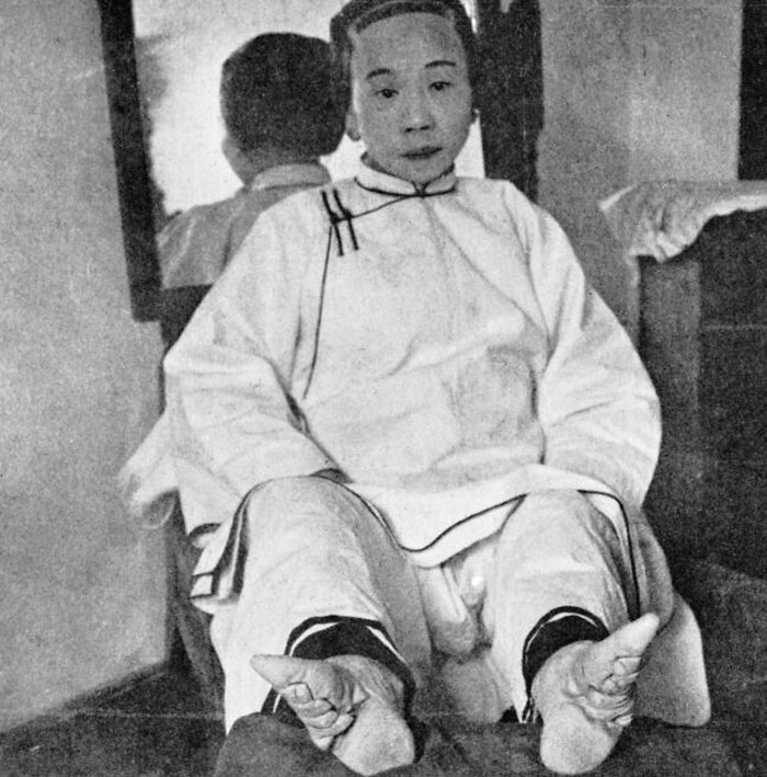 Mujer china cuyos pies fueron vendados desde su infancia. Finales del siglo XIX